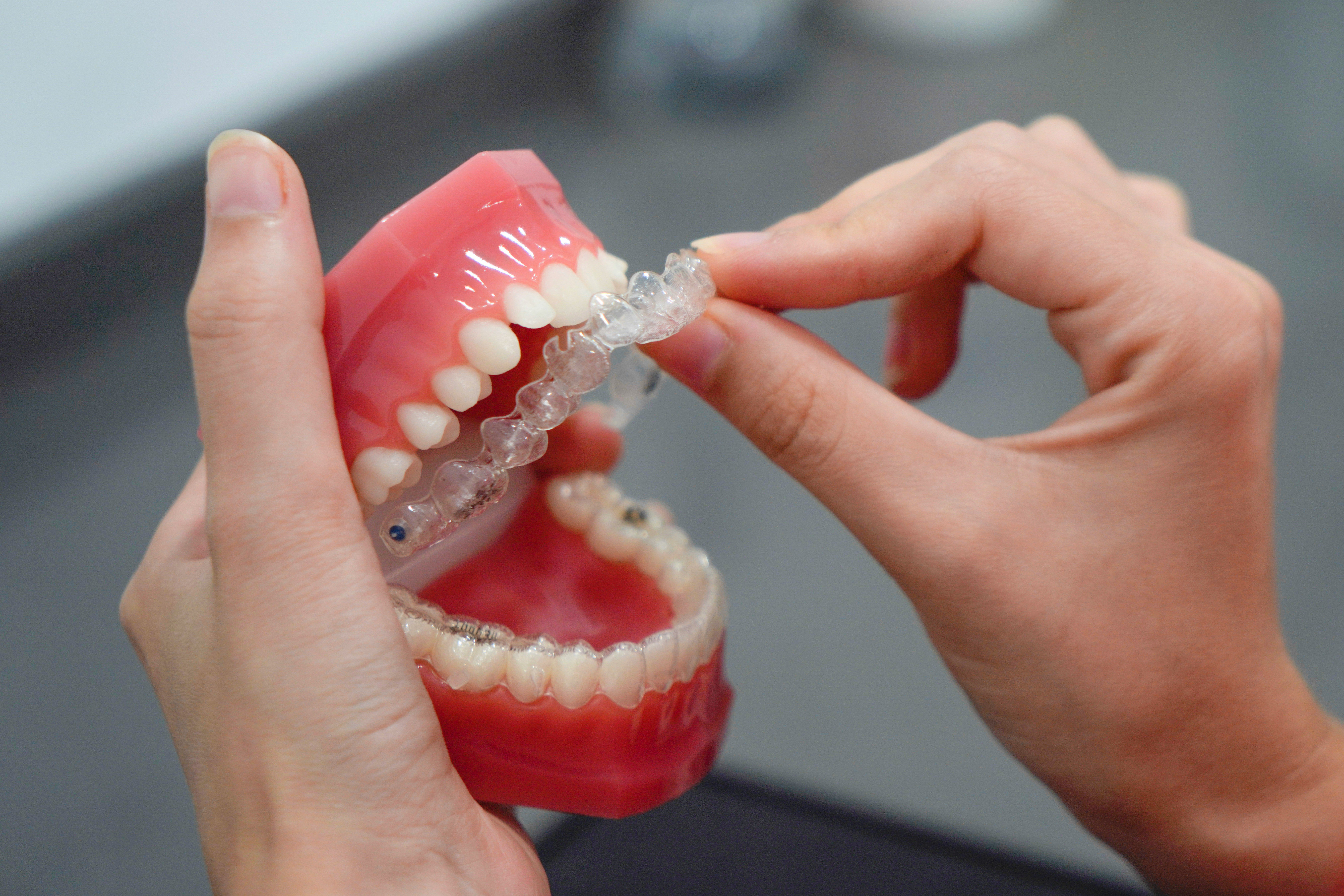 Straightening Your Smile the Natural Way: Invisalign® at Kudlik Dental
